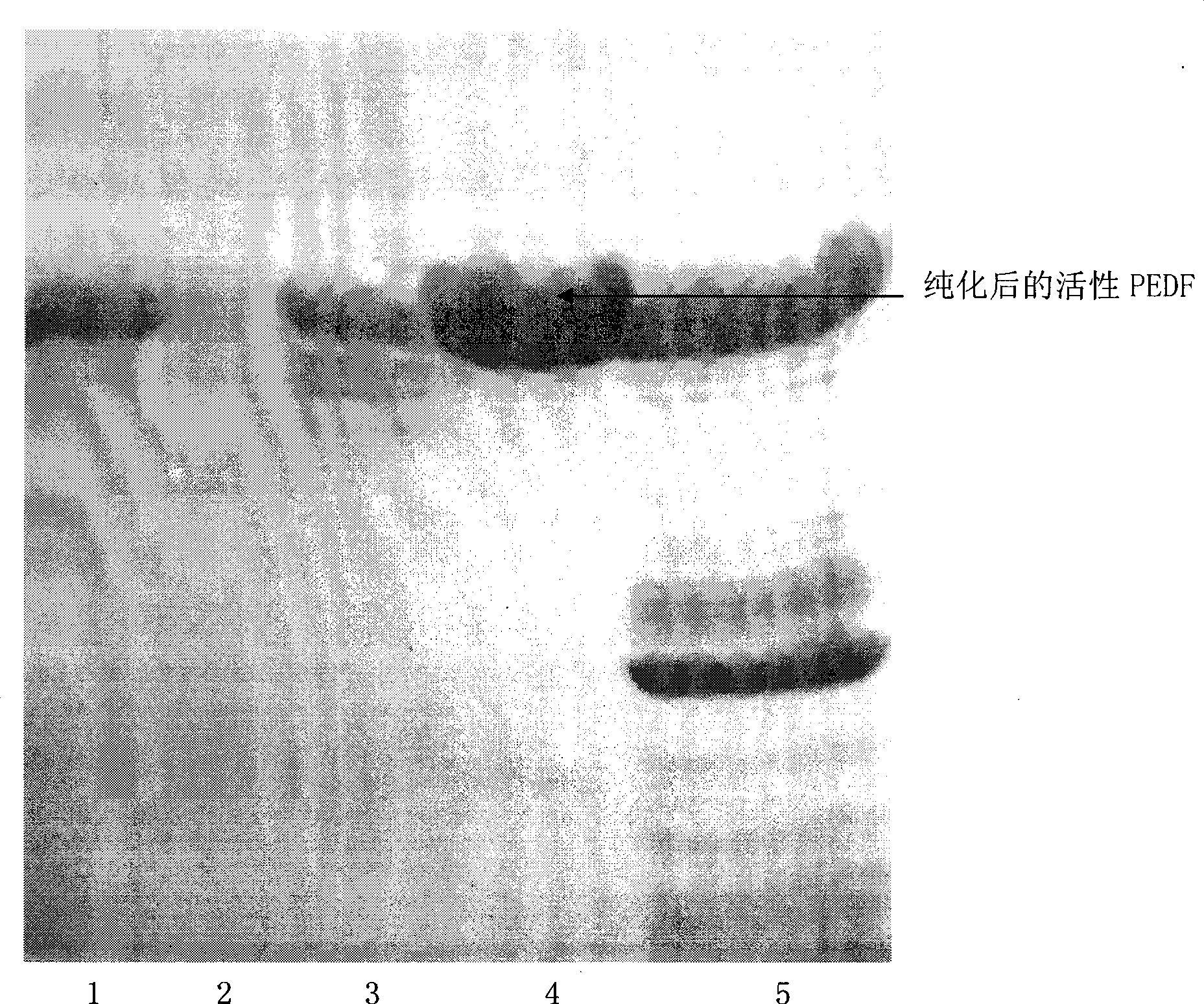 Compound containing pigment epidermal derived factors and preparation method and application thereof