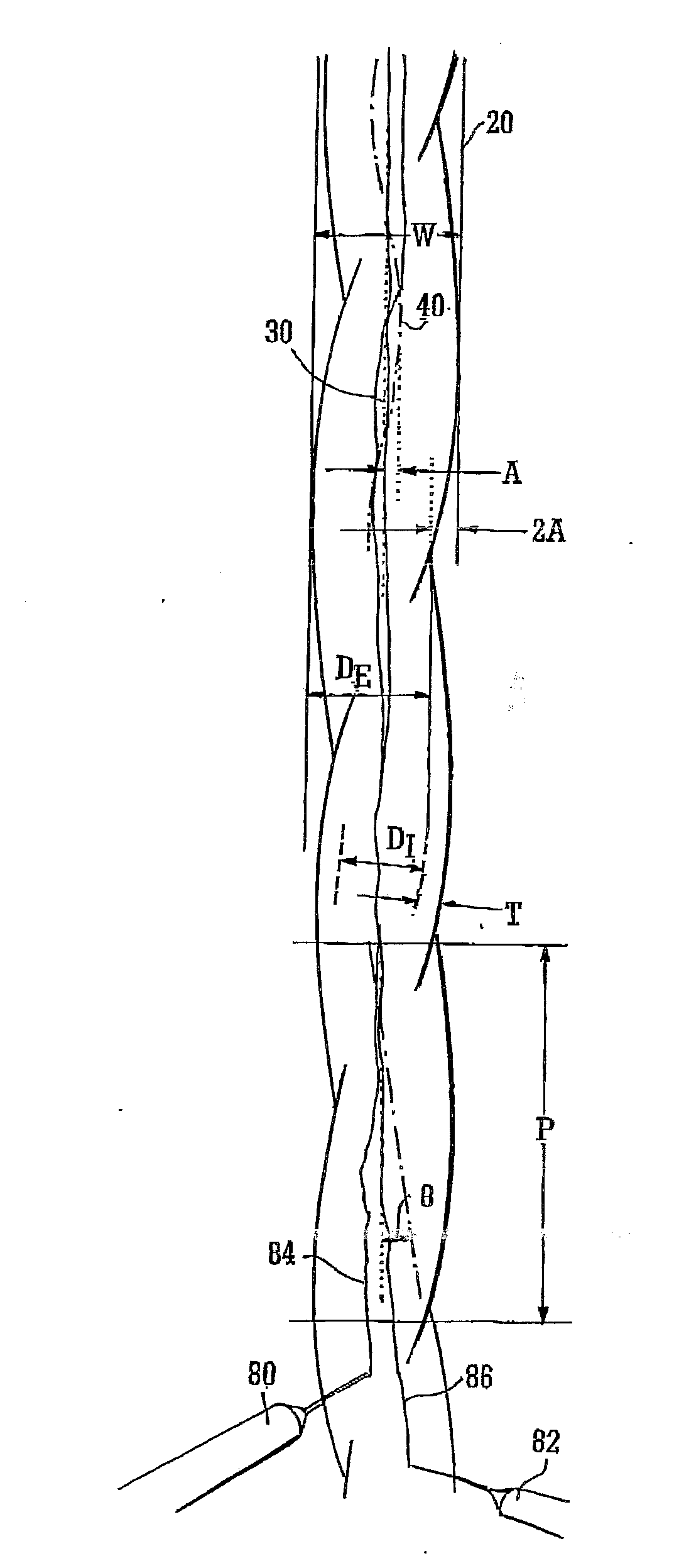 Helical graft