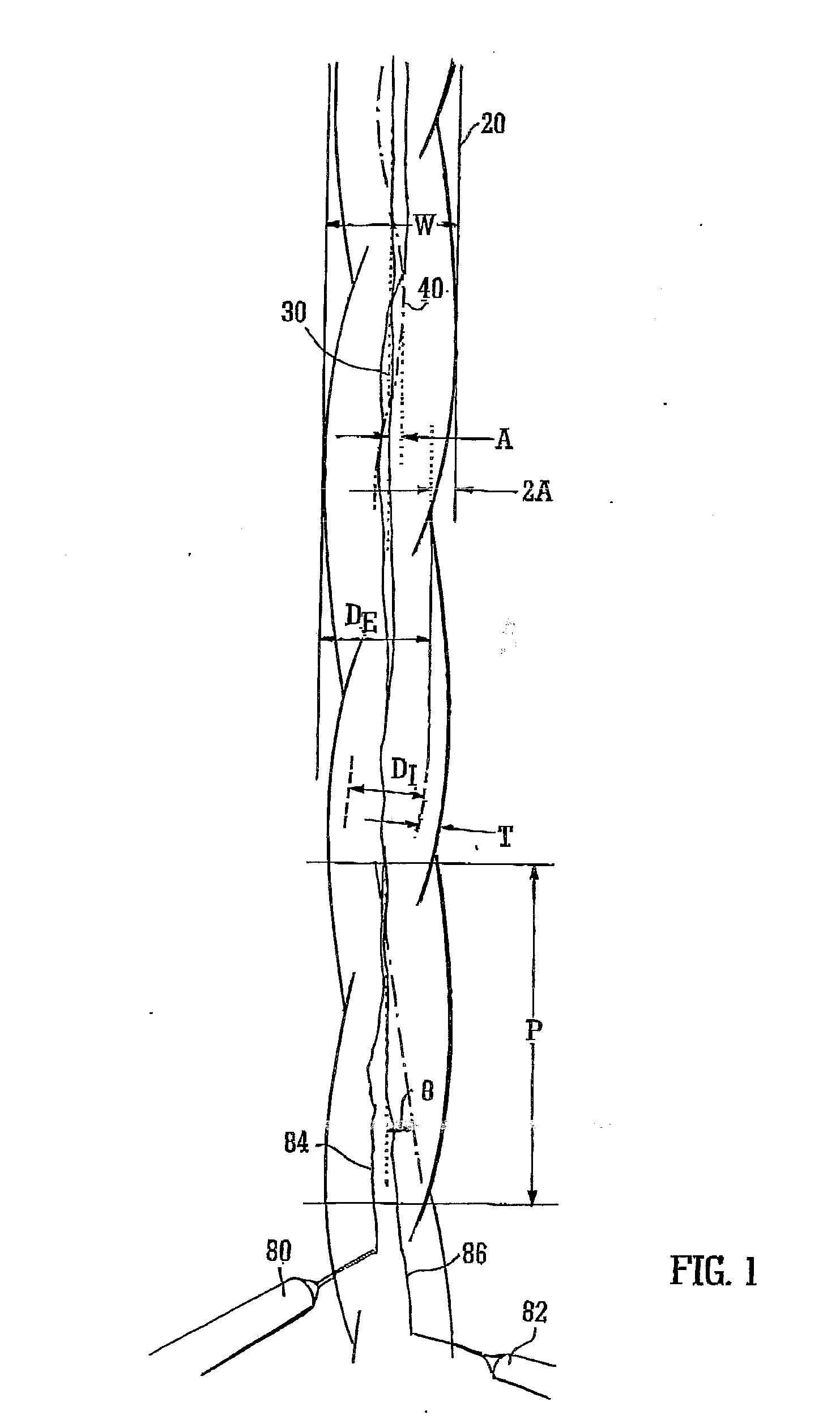 Helical graft