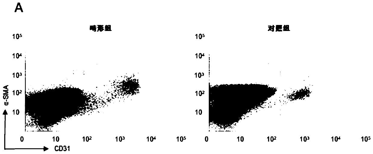 Application of lovastatin or pharmaceutically acceptable salt thereof in preparation of drugs for treating cerebral arteriovenous malformation