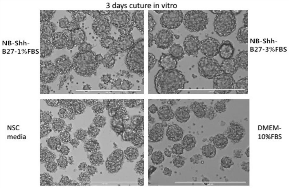 A kind of culture medium and culture method for culturing brain tumor cells in vitro