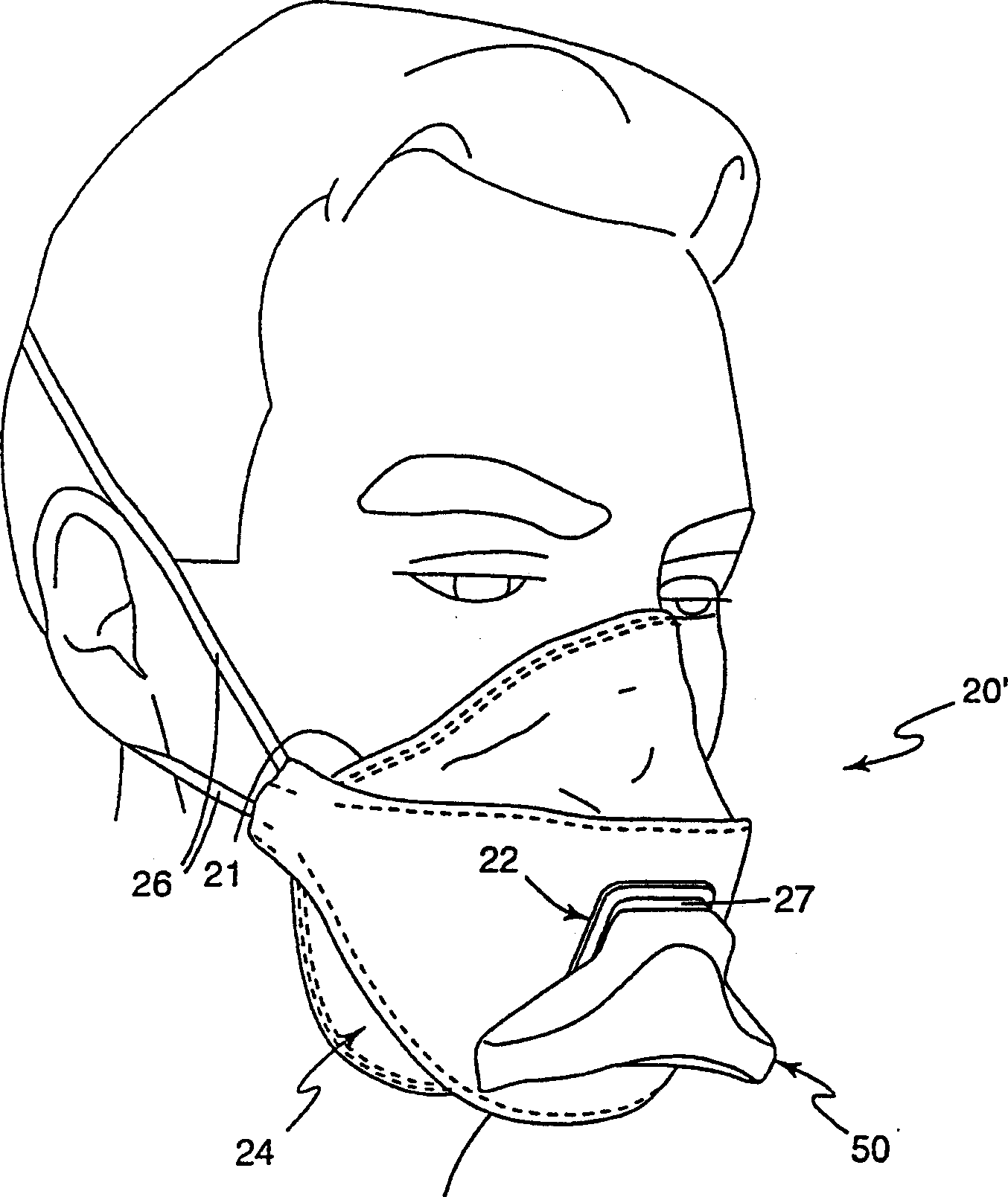 Respiration that includes integral filter element, exhalation valve and impactor element