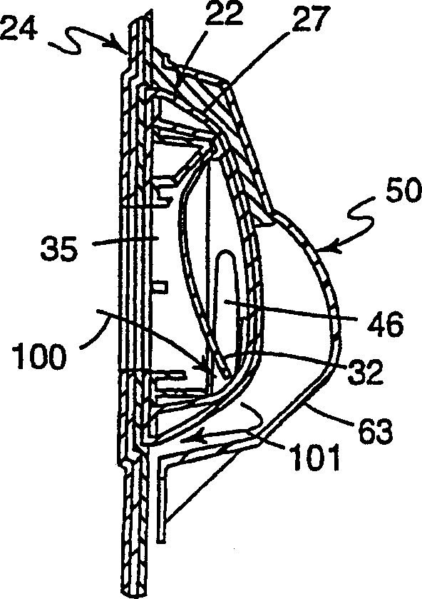 Respiration that includes integral filter element, exhalation valve and impactor element