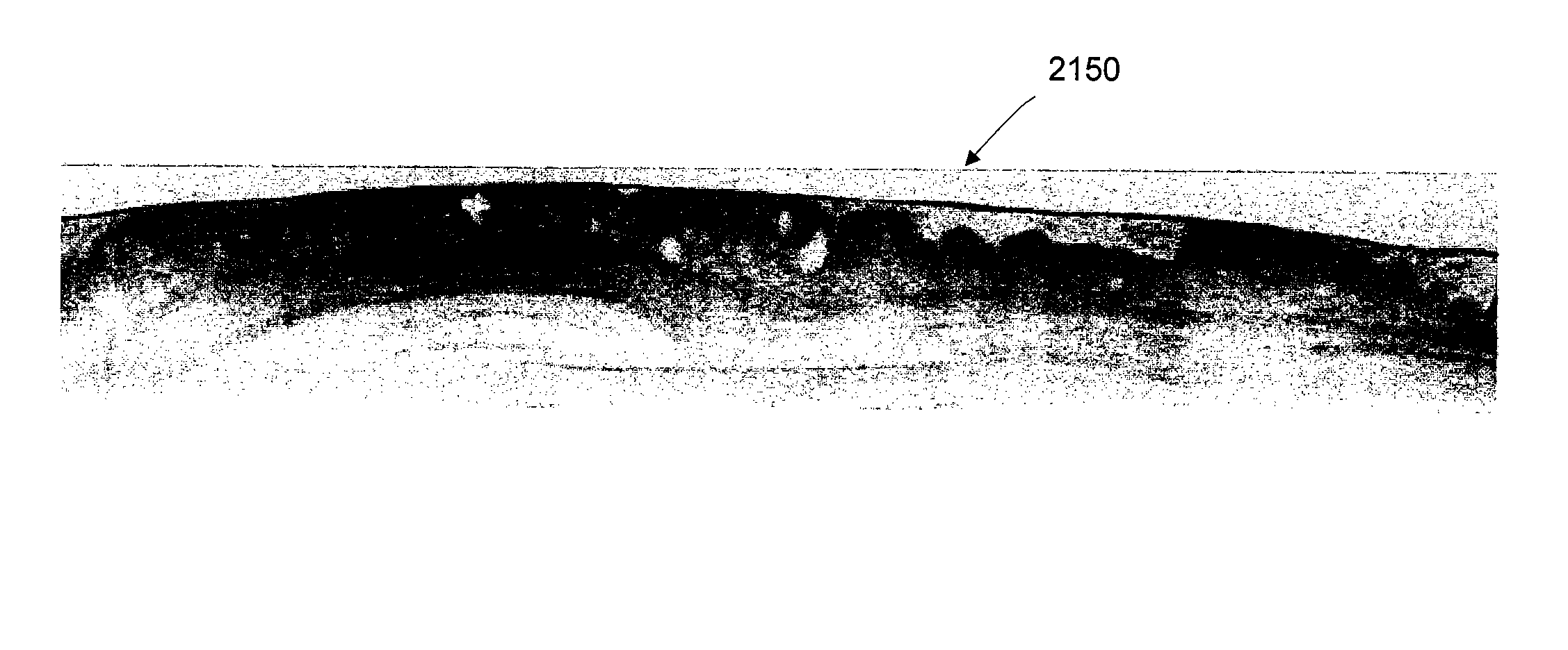 Methods and systems for monitoring and obtaining information of at least one portion of a sample using conformal laser therapy procedures, and providing electromagnetic radiation thereto