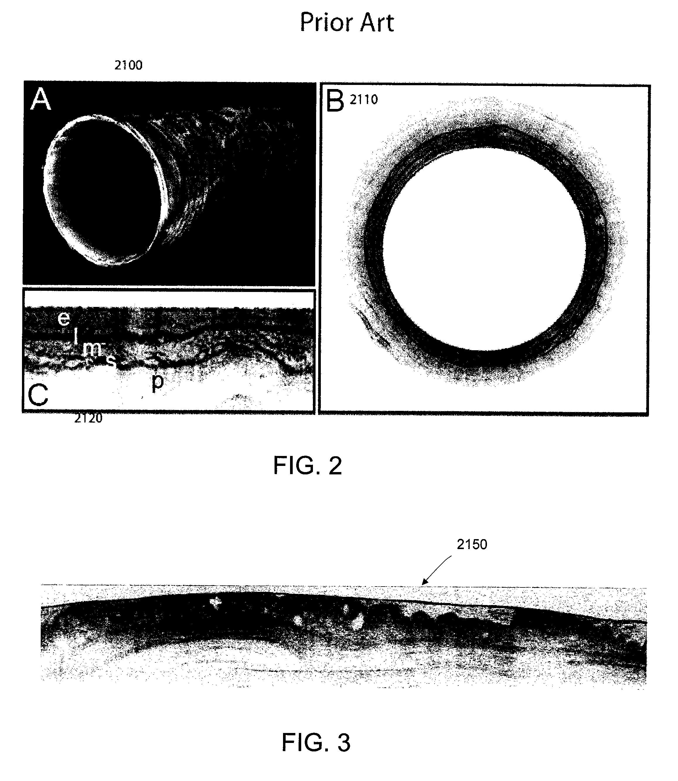 Methods and systems for monitoring and obtaining information of at least one portion of a sample using conformal laser therapy procedures, and providing electromagnetic radiation thereto