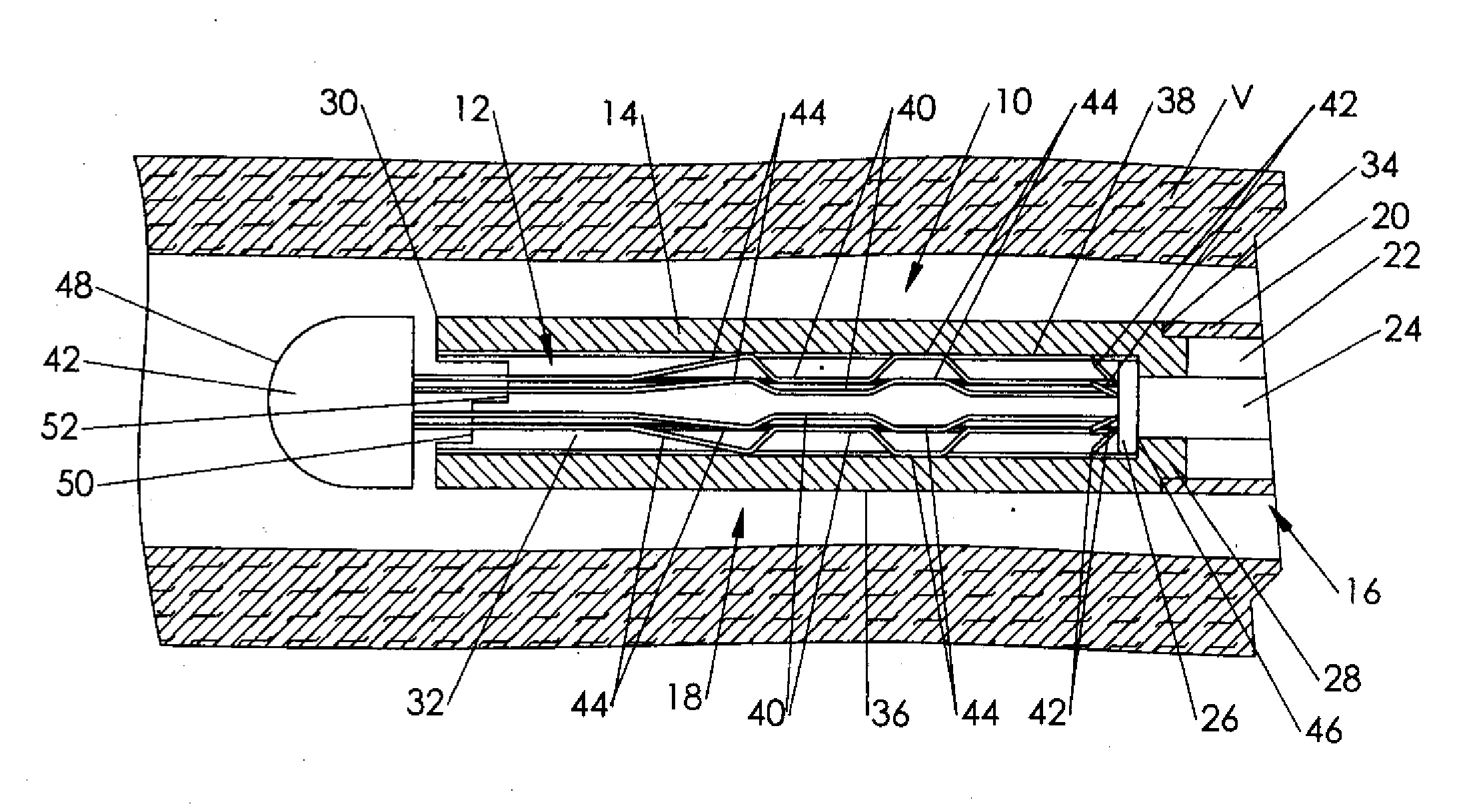 Staged release of ivc filter legs