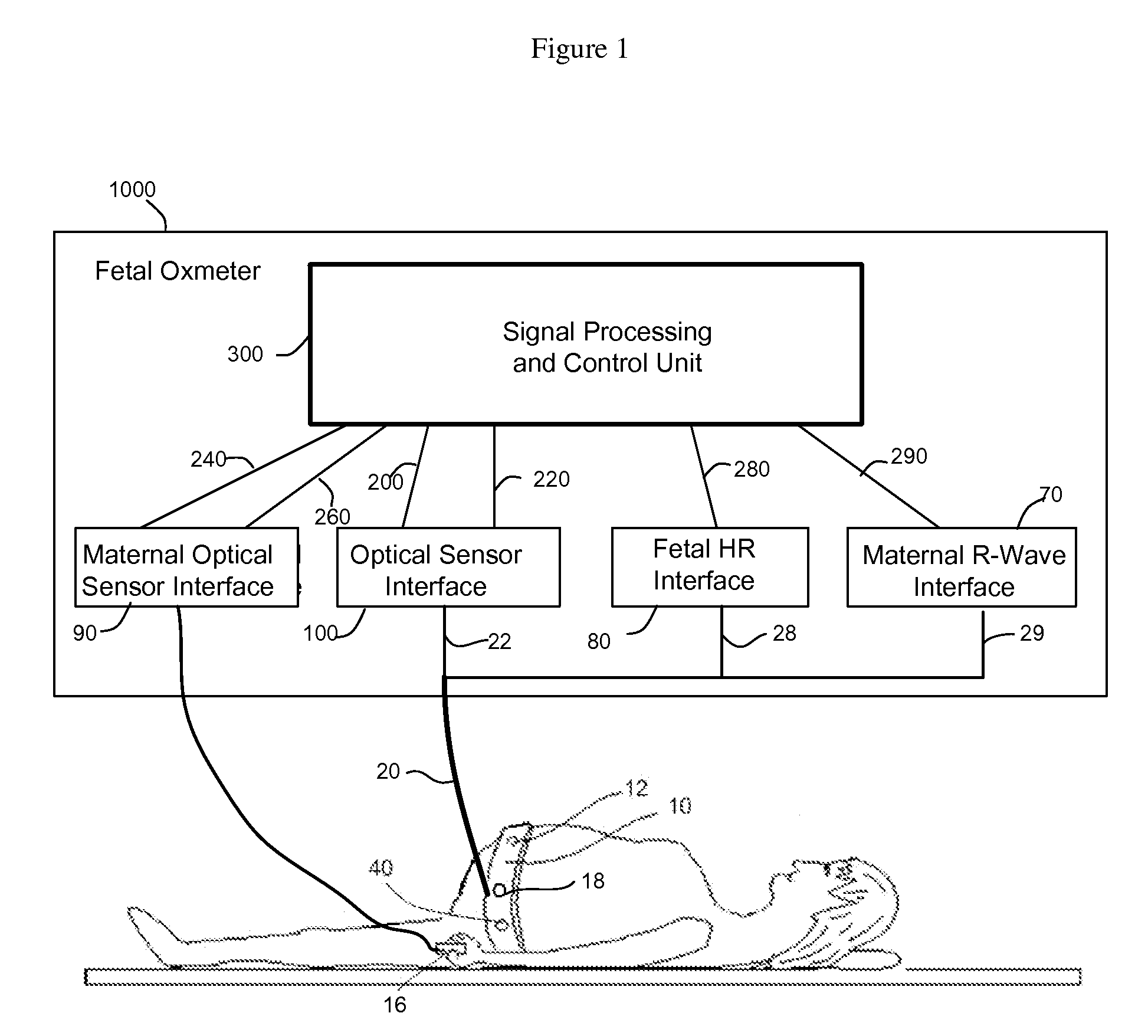 Method and apparatus for non-invasive fetal oximetry