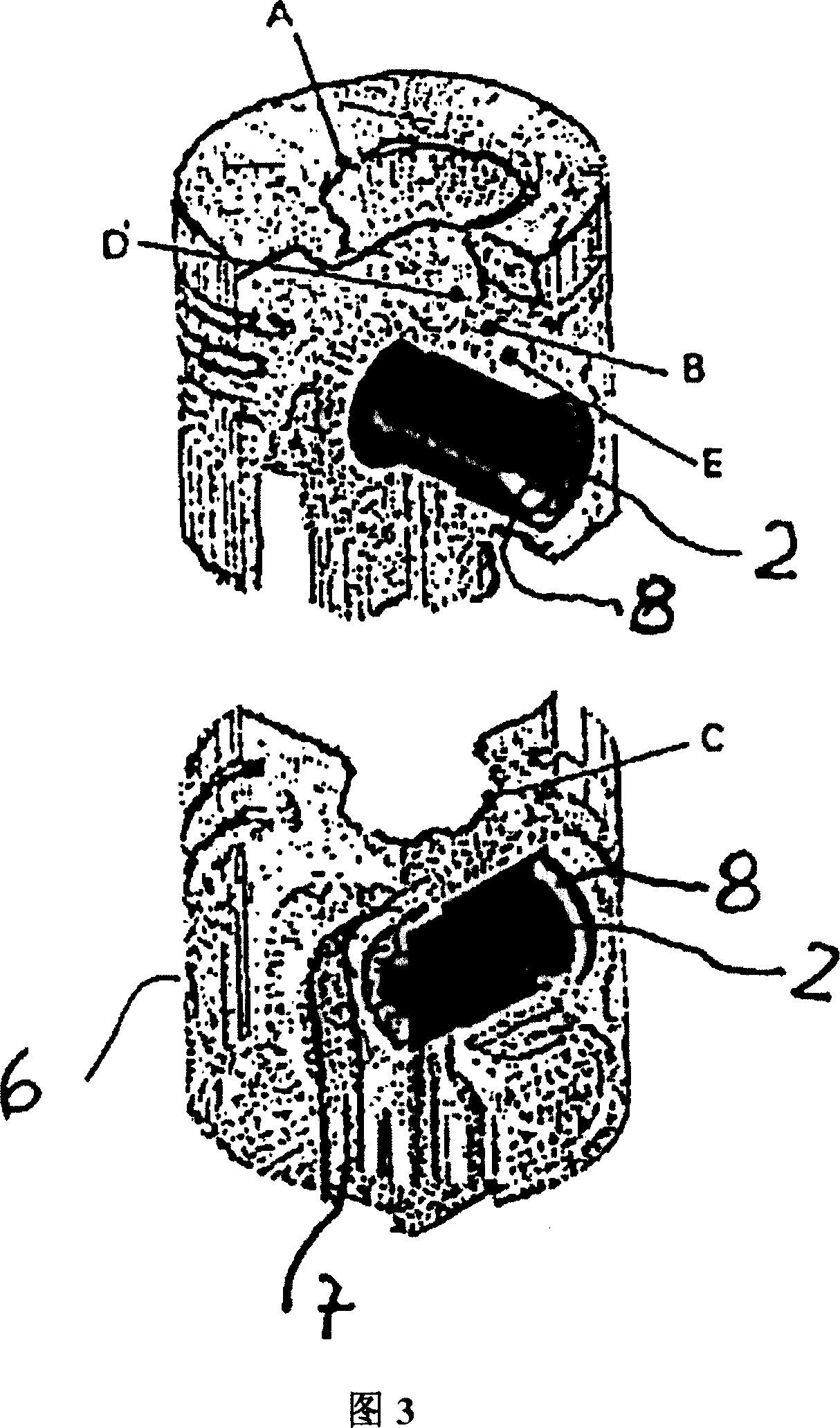 Piston-pin bearing for internal combustion engines