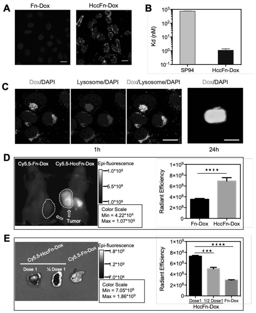 A nano-drug carrier loaded with anti-tumor drugs, its preparation method and application