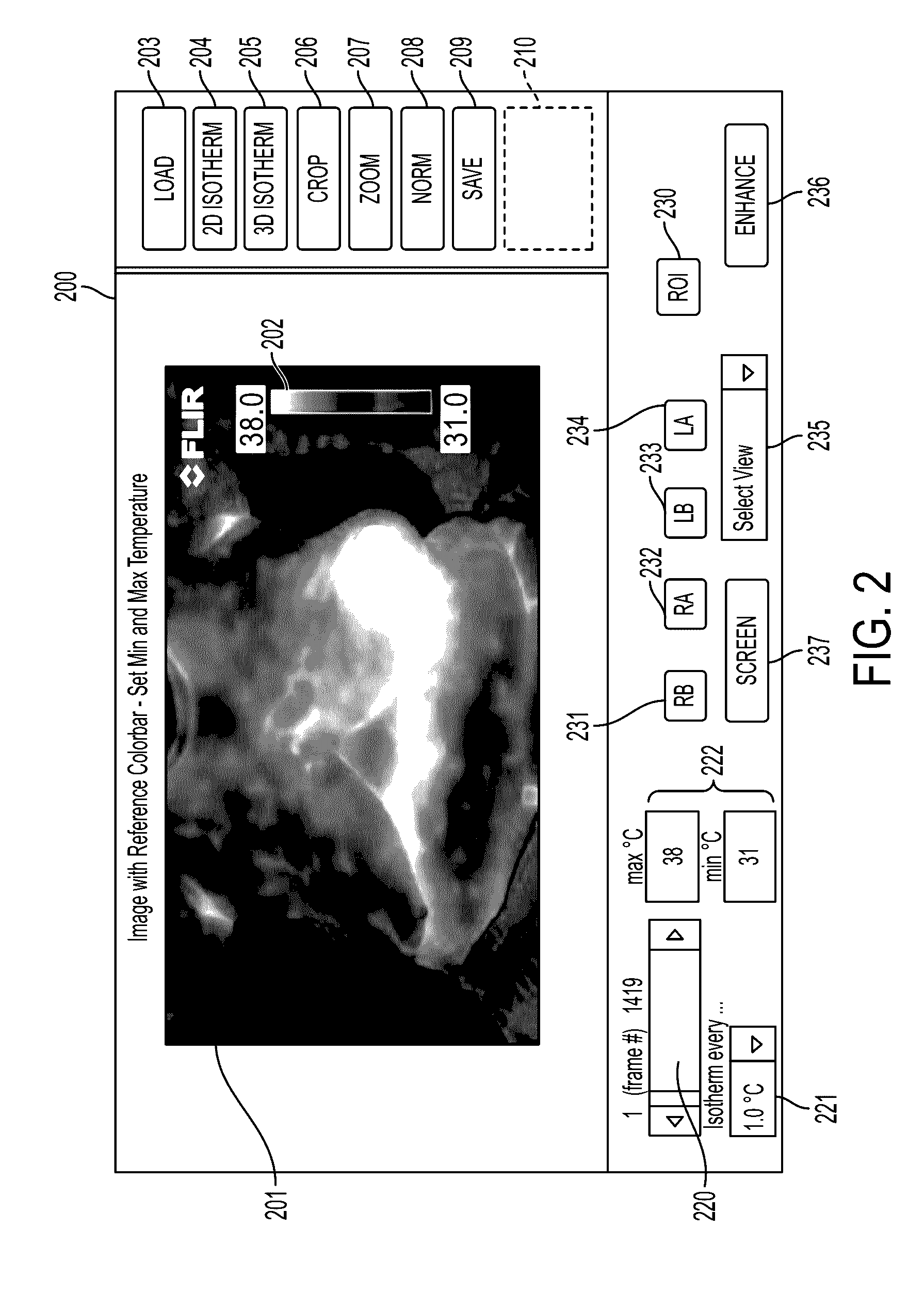 Detecting tumorous breast tissue in a thermal image