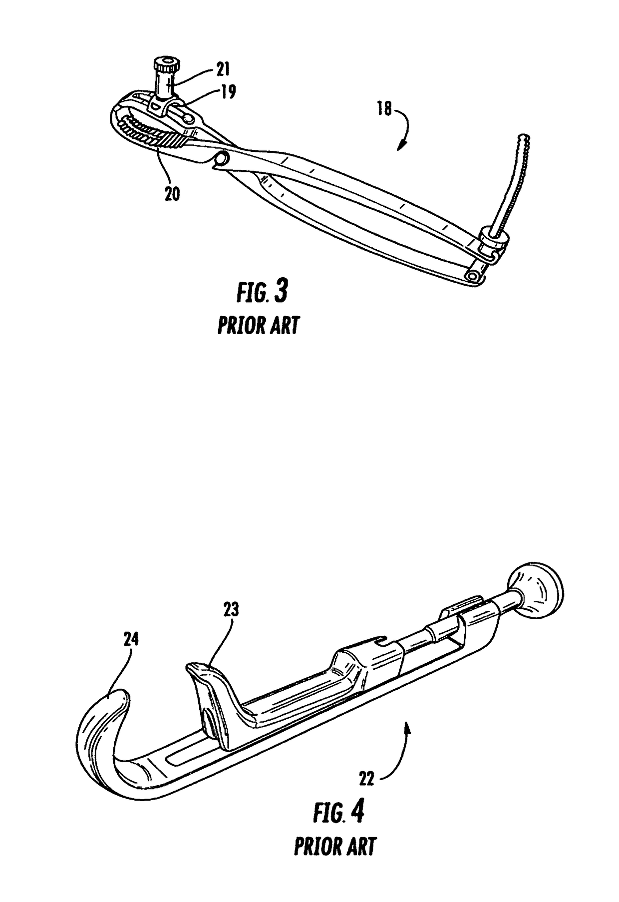 Bone clamp