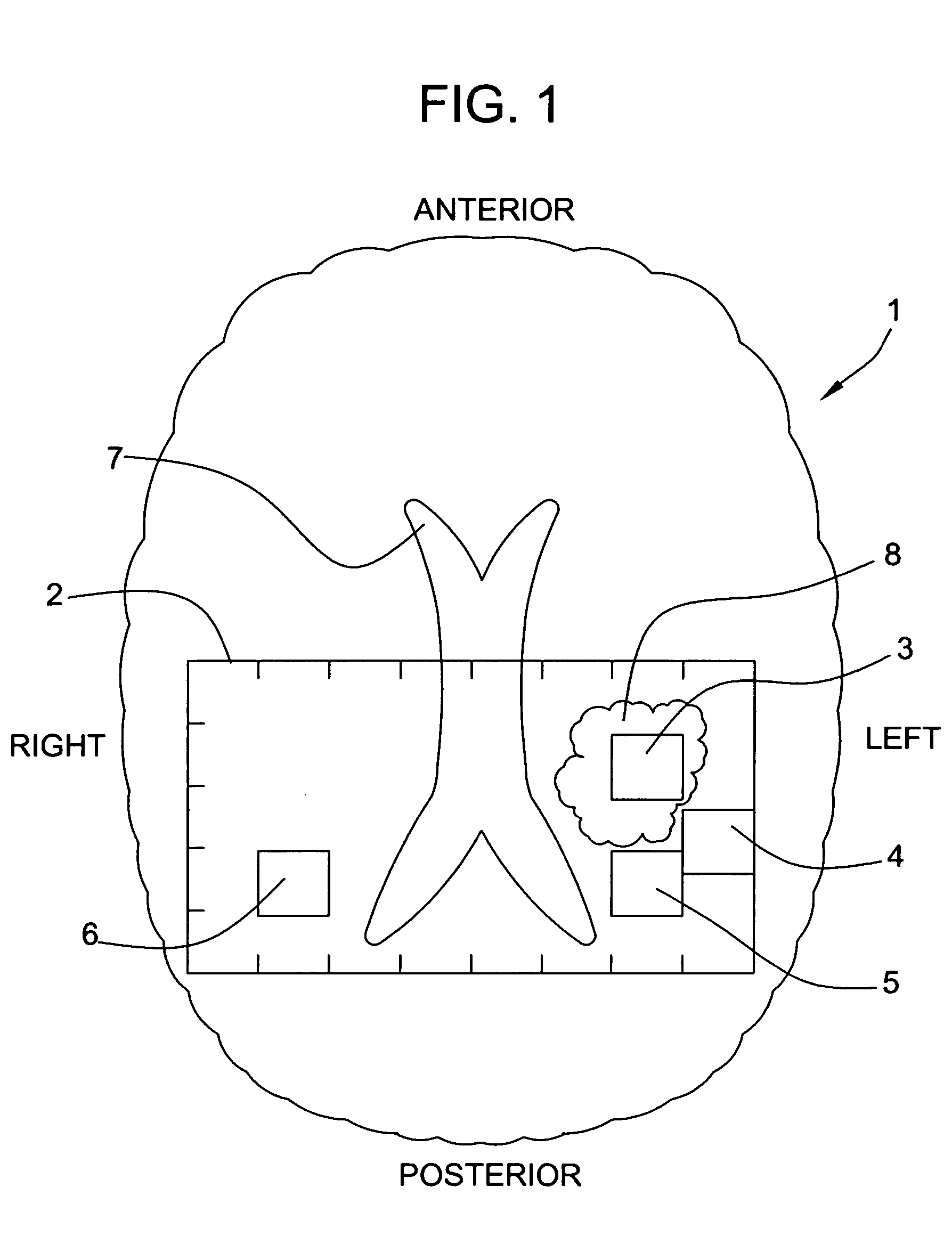 Method for monitoring early treatment response