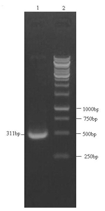 Anti-tumor targeting engineering bacteria and bacterial agent and method for preparing bacterial agent