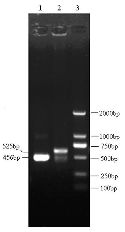 Anti-tumor targeting engineering bacteria and bacterial agent and method for preparing bacterial agent