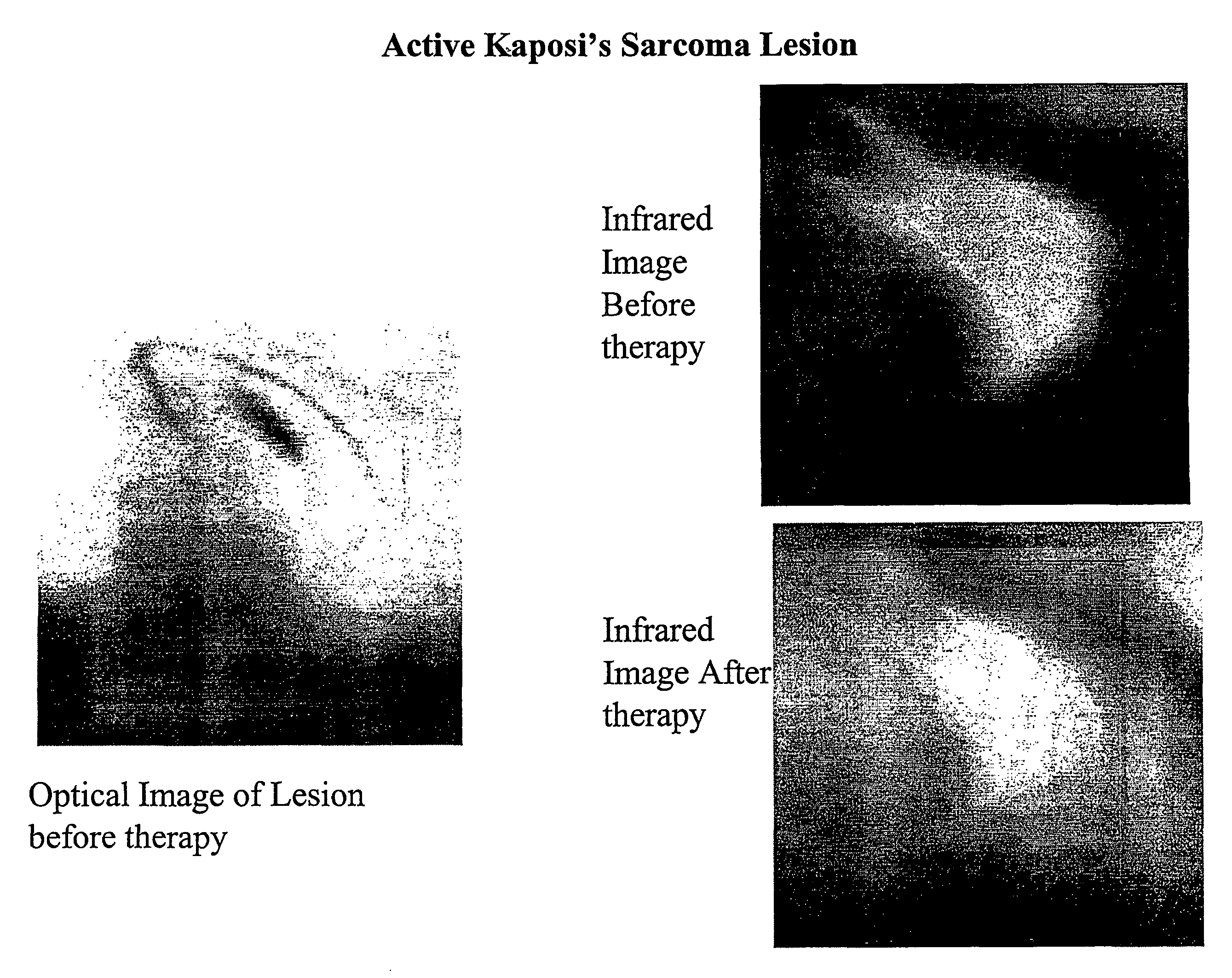 Method for imaging and spectroscopy of tumors and determination of the efficacy of anti-tumor drug therapies