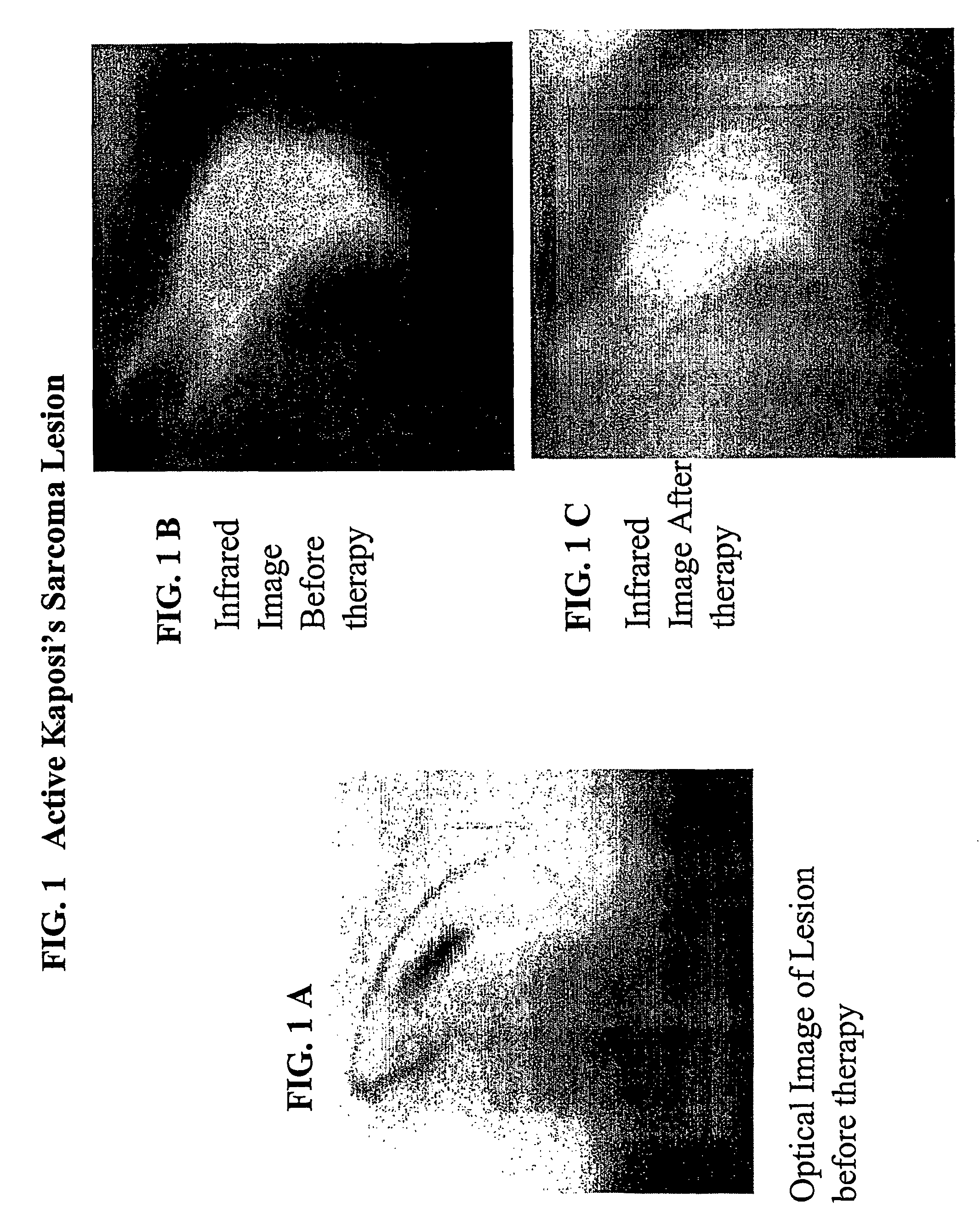 Method for imaging and spectroscopy of tumors and determination of the efficacy of anti-tumor drug therapies