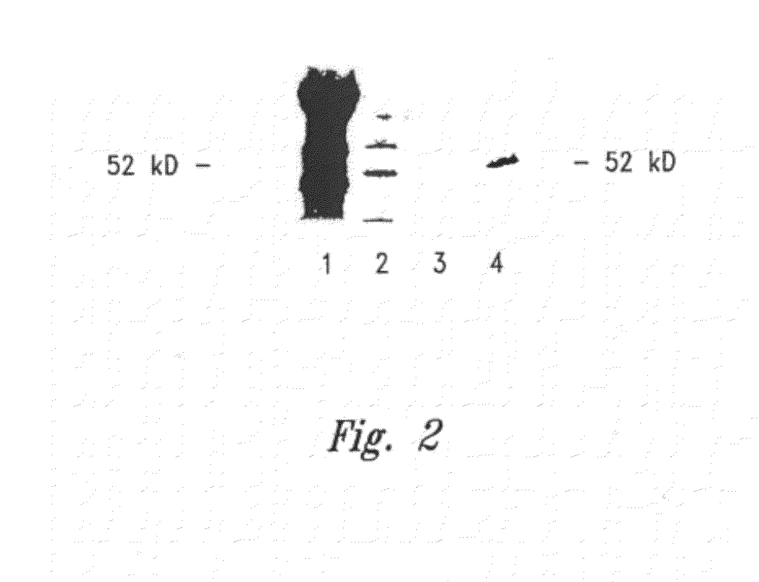 Compositions and methods for wt1 specific immunotherapy