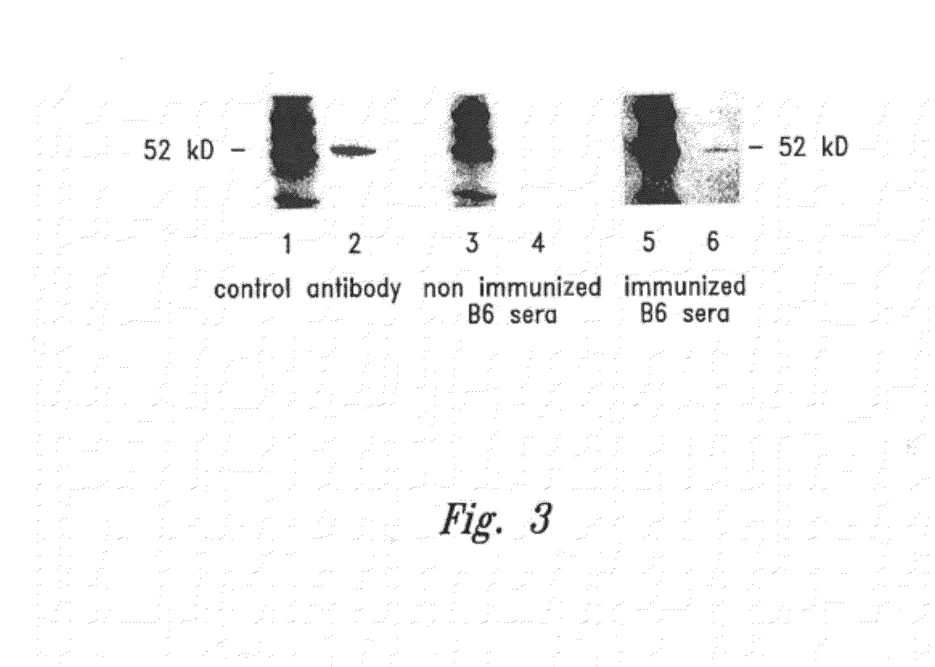 Compositions and methods for wt1 specific immunotherapy