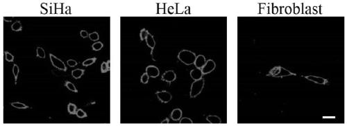 Fluorescent probe for rapidly displaying normal state and near-zero state of potential of cell membrane and application thereof