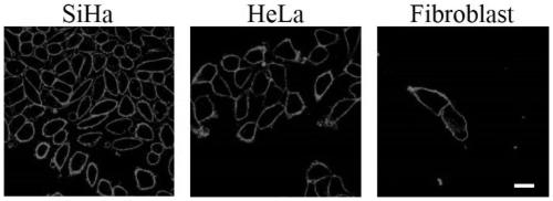 Fluorescent probe for rapidly displaying normal state and near-zero state of potential of cell membrane and application thereof