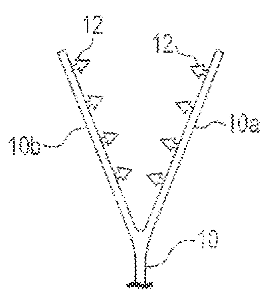 Suture-less tissue fixation for implantable device