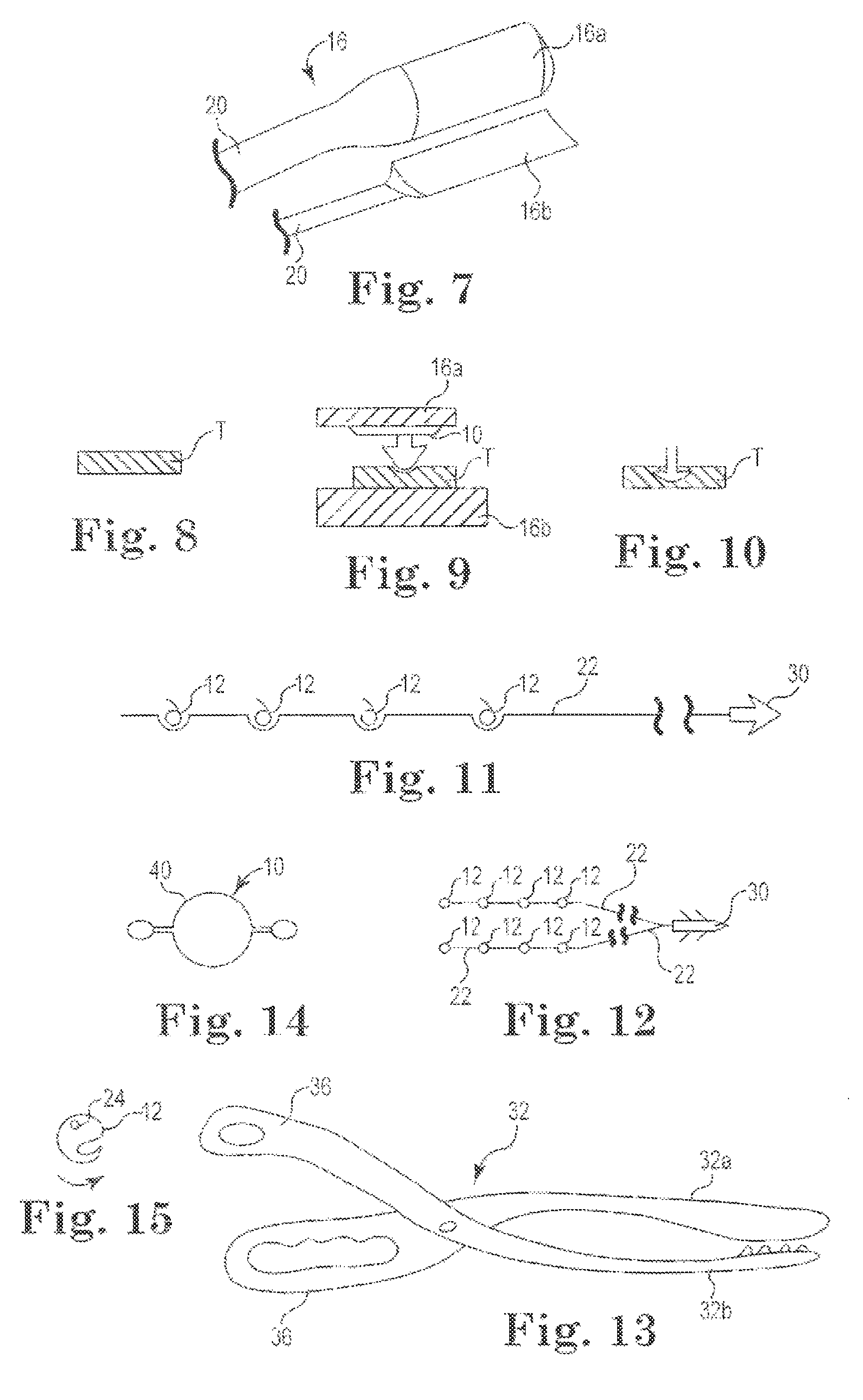 Suture-less tissue fixation for implantable device