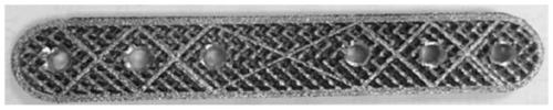 Personalized 3D printed porous titanium-based tantalum-coated bone plate and its preparation method