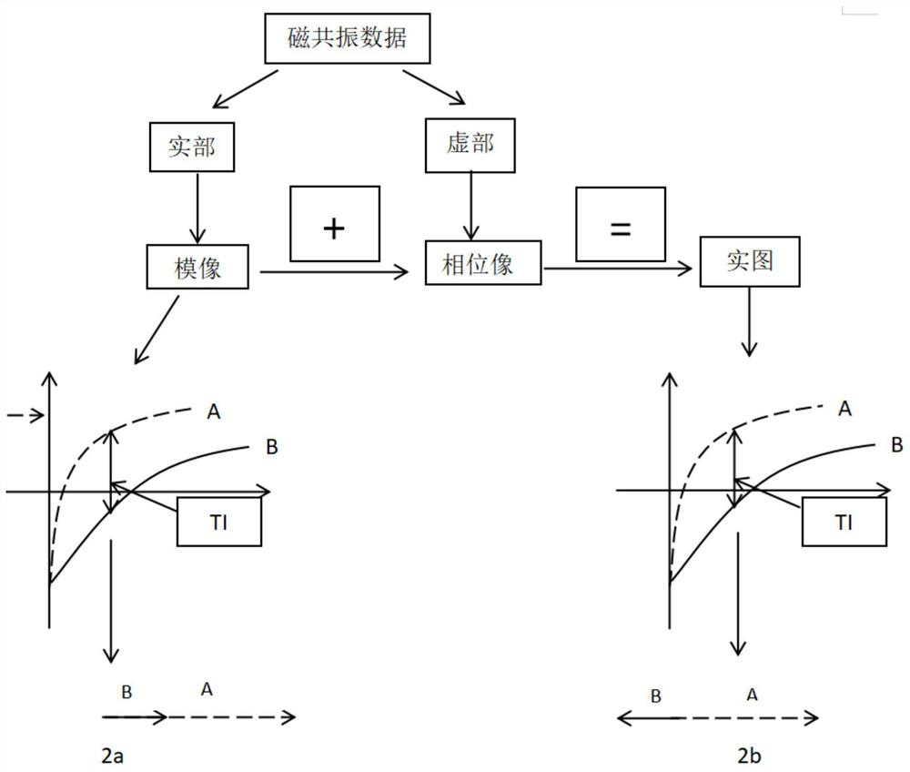 Water-fat separation method and system based on inversion recovery real image reconstruction