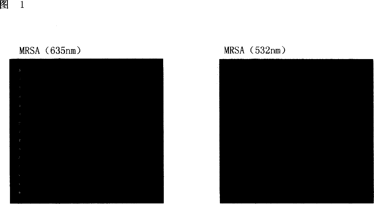 Medicine and bacterium resistant detection chip, method for preparation and application thereof