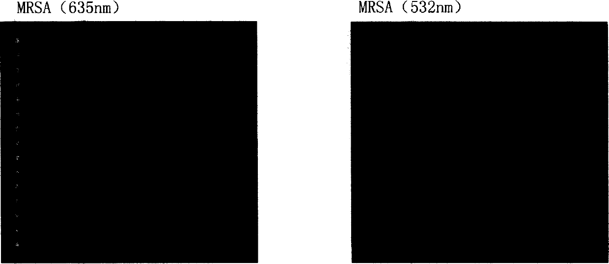 Medicine and bacterium resistant detection chip, method for preparation and application thereof