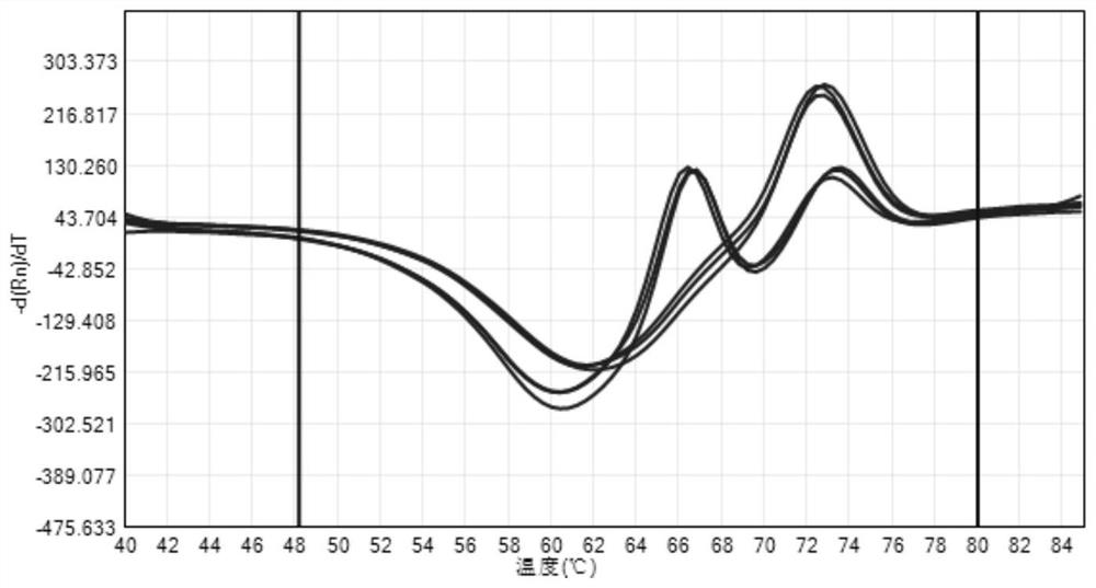 Probe, primer and kit for detecting gene polymorphism of methylenetetrahydrofolate reductase (MTHFR)