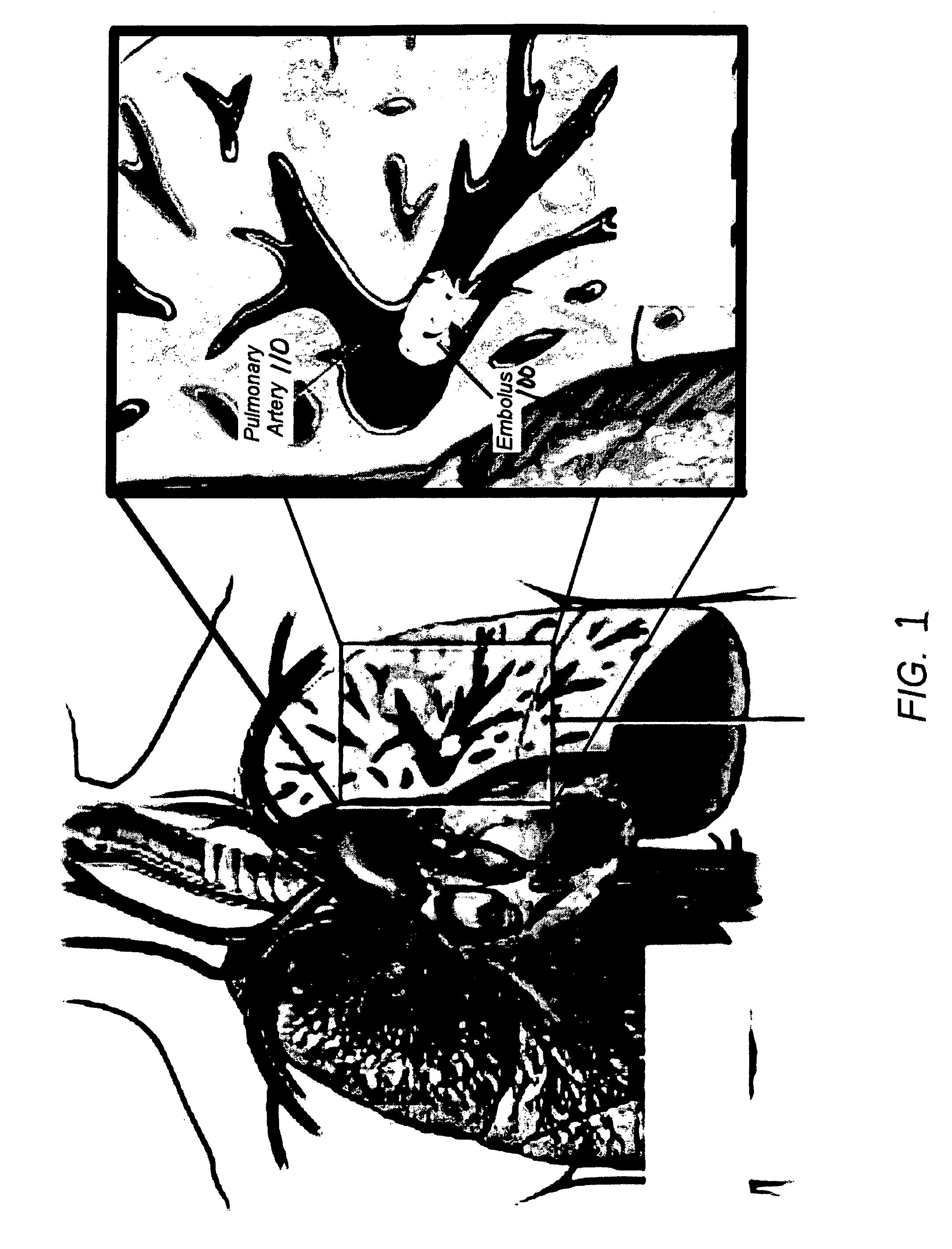 Method for segmenting arteries and veins