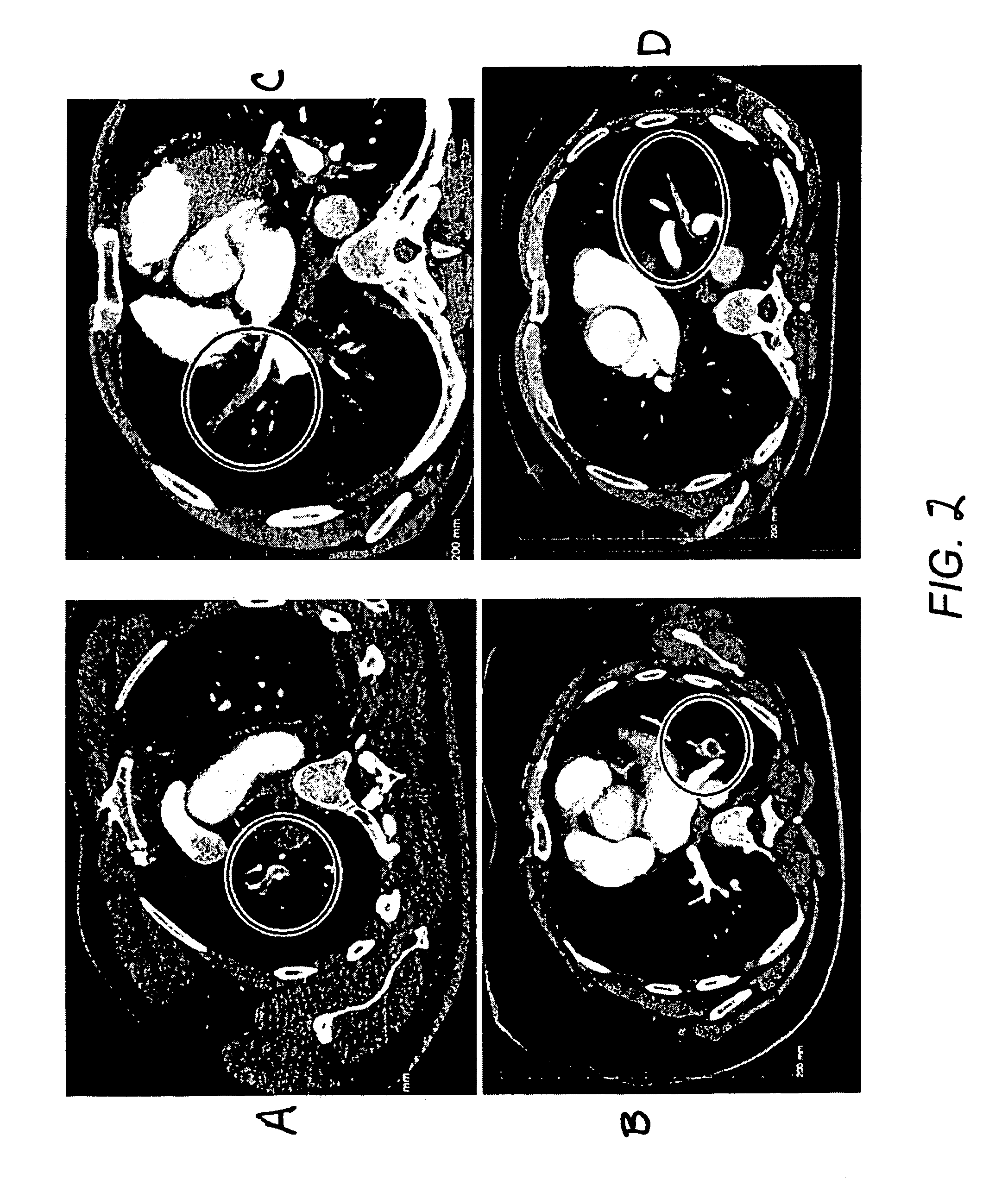 Method for segmenting arteries and veins