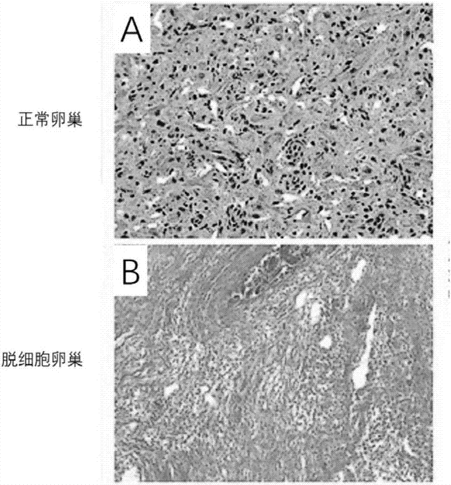 Natural tissue derived ovarian acellular material and preparation method thereof