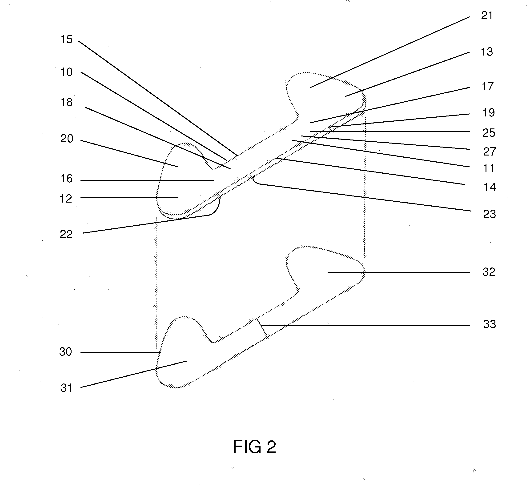 Simplified nasal dilator