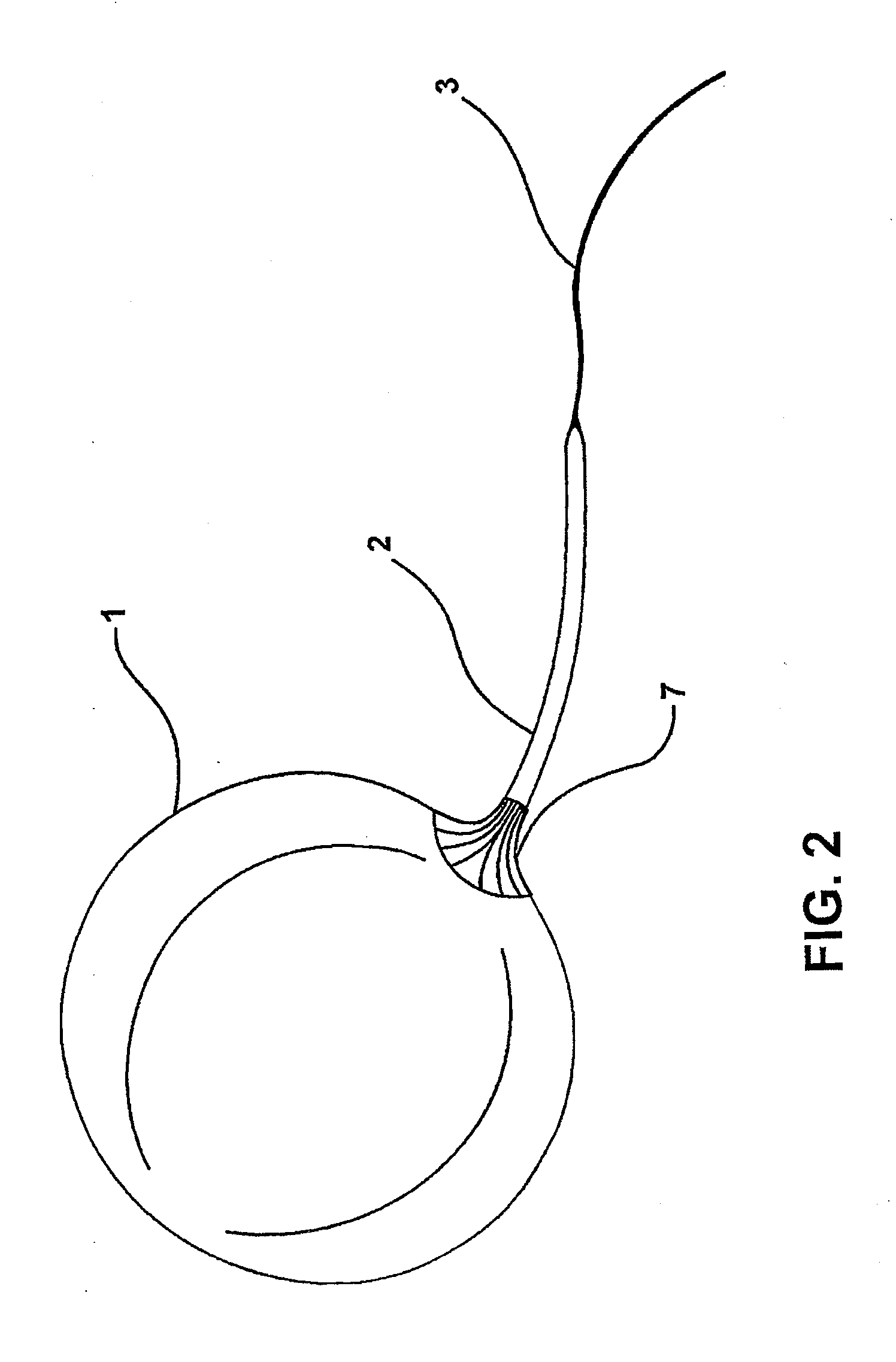 Intragastric balloon assembly