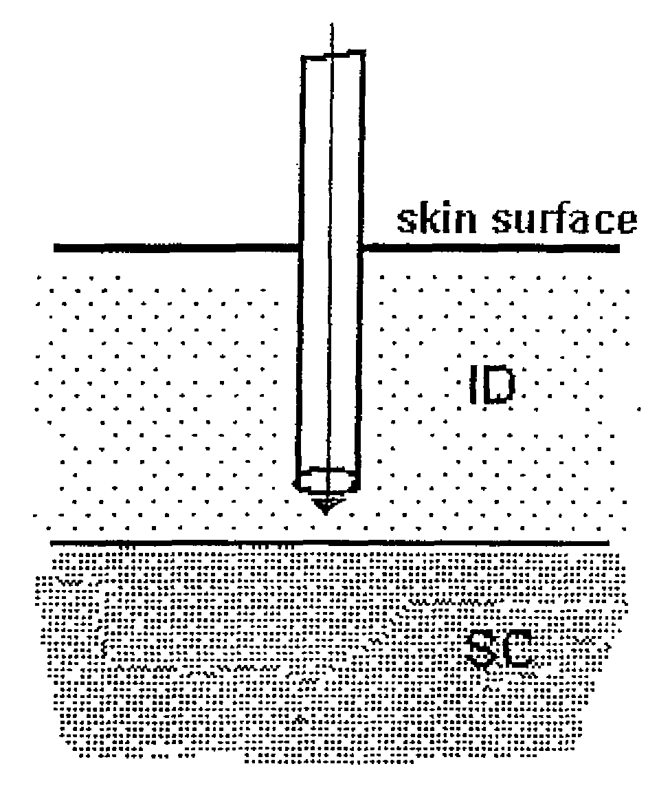 Method and device for controlling drug pharmacokinetics