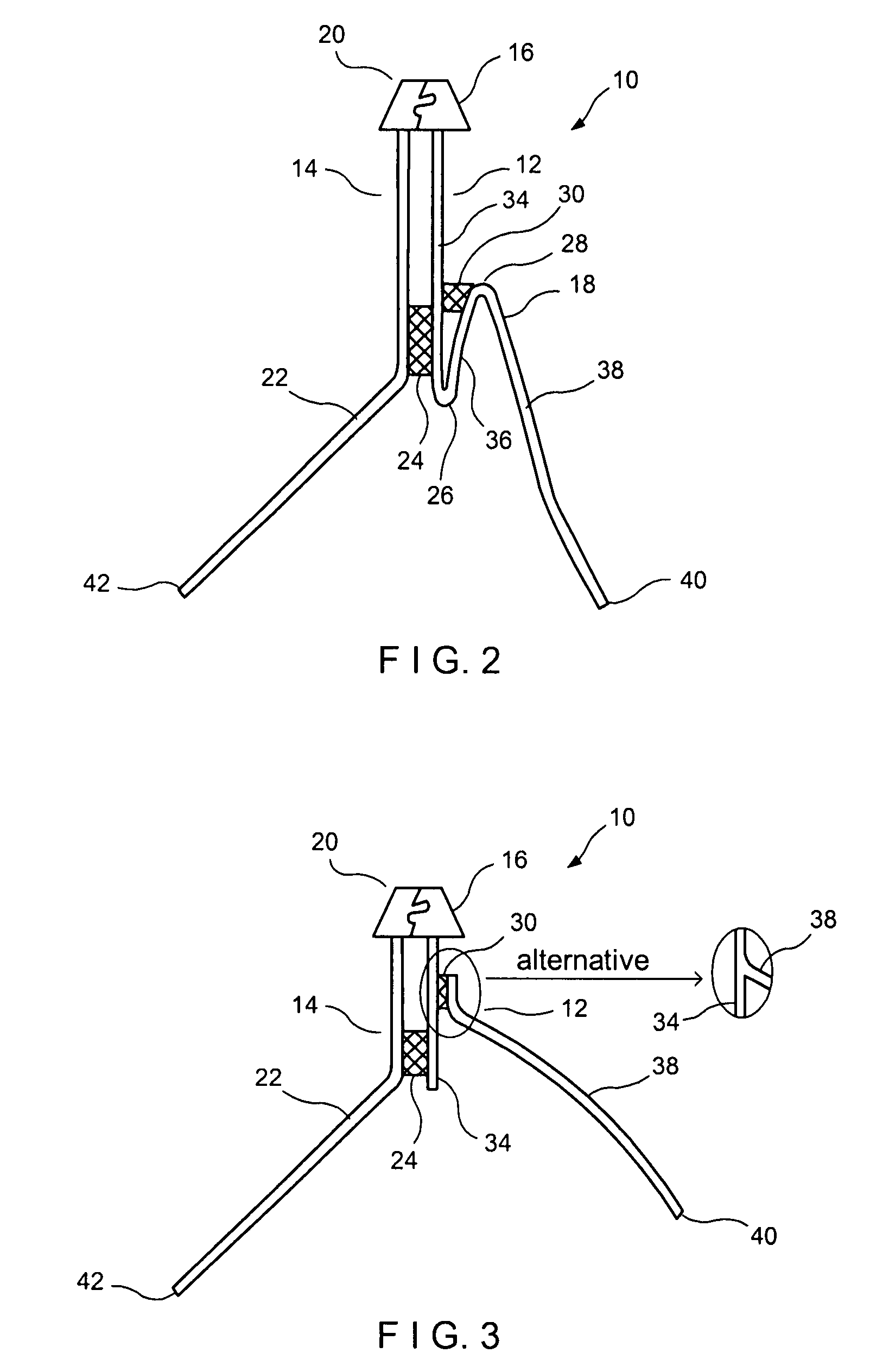 High burst zipper assembly for large reclosable packages