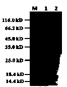 Method for expressing and purifying human cytoplasmic gelsolin