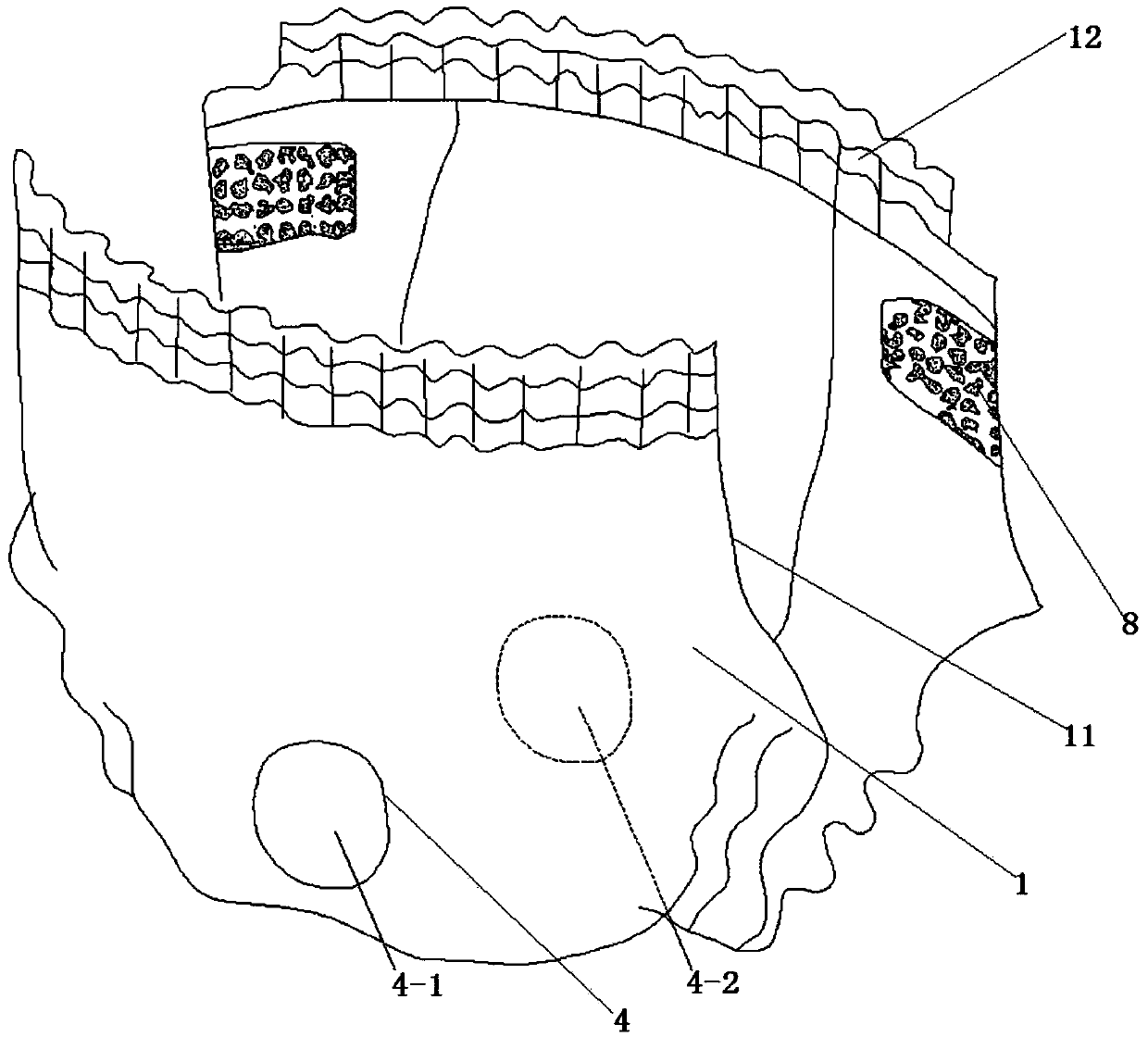 Disposable nursing device with functions of inverted-leakage prevention and collection of feces and urine