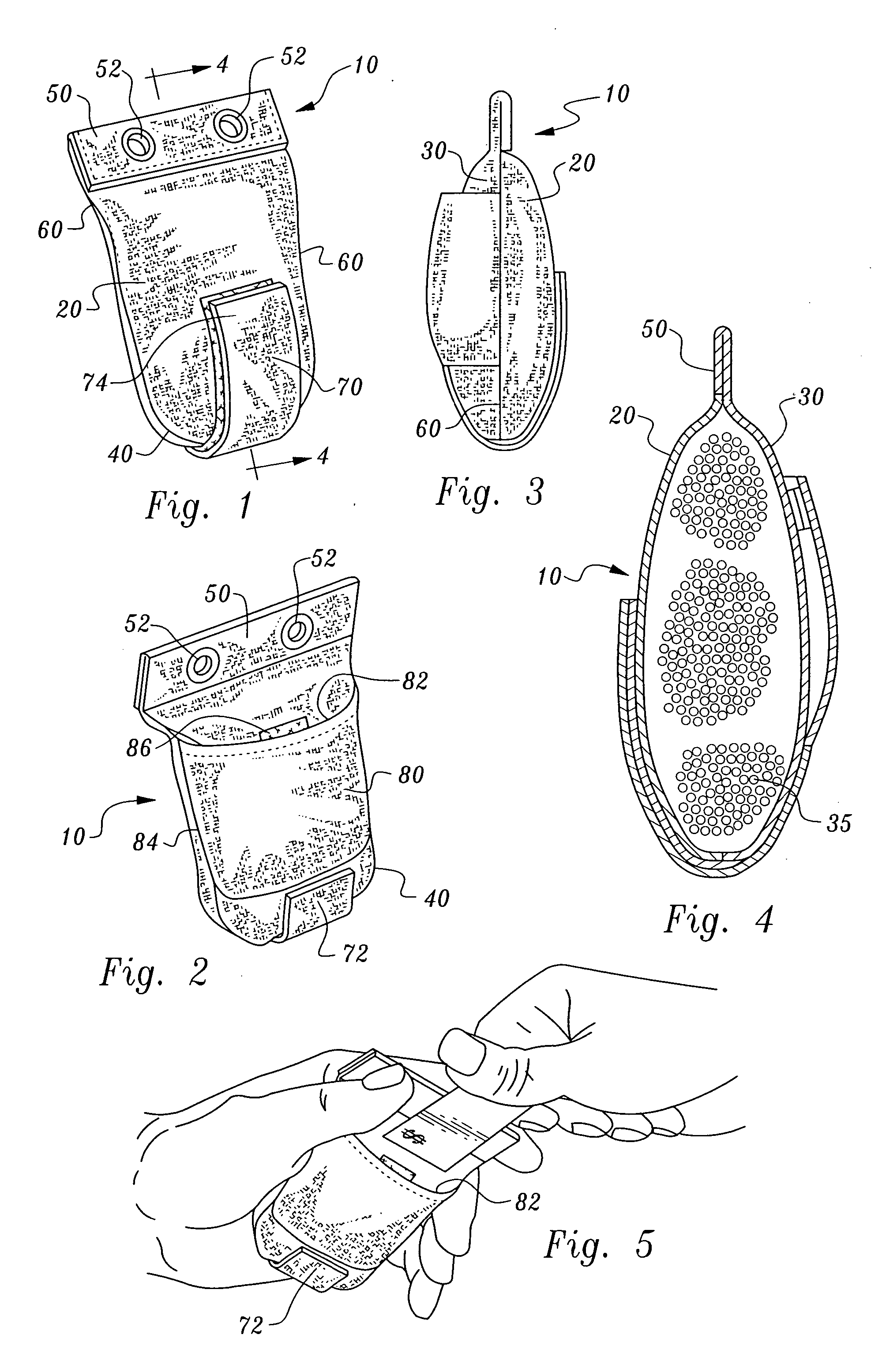 Method and apparatus for removable shoe weights