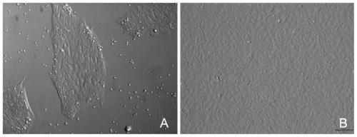 Method for preparing macrophage by iPS cell differentiation