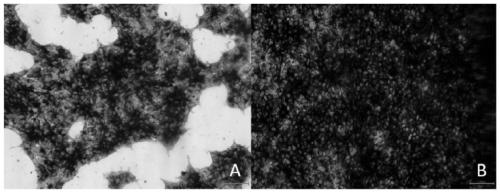 Method for preparing macrophage by iPS cell differentiation