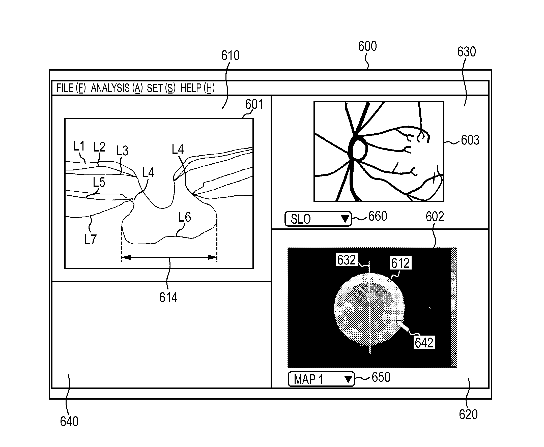 Image processing apparatus, image processing method, and program