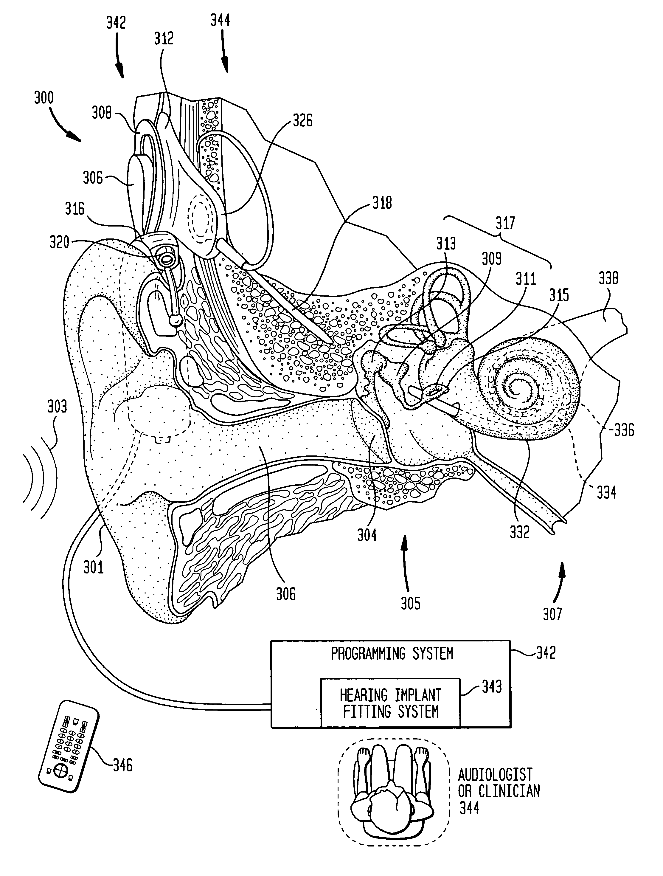 Focused stimulation in a medical stimulation device