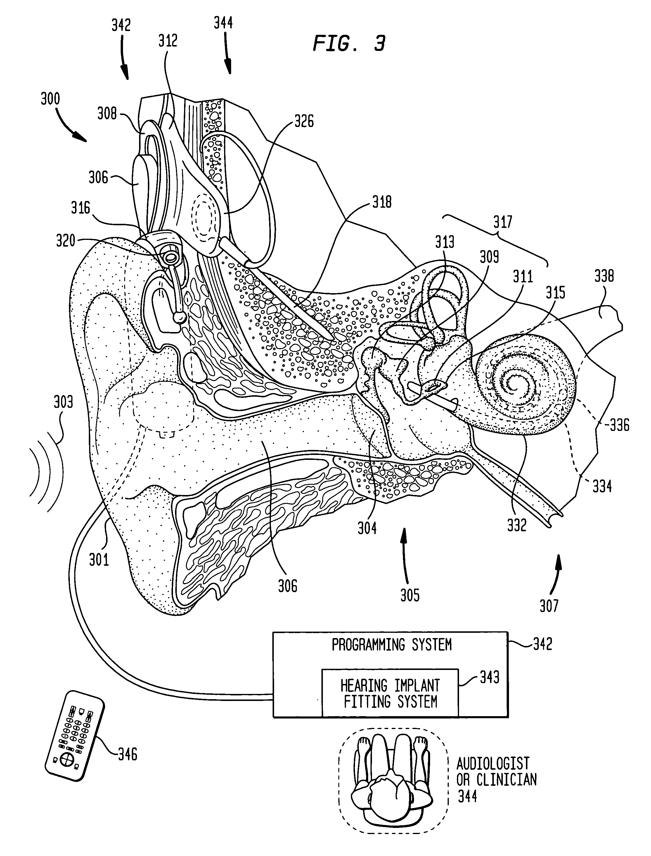 Focused stimulation in a medical stimulation device