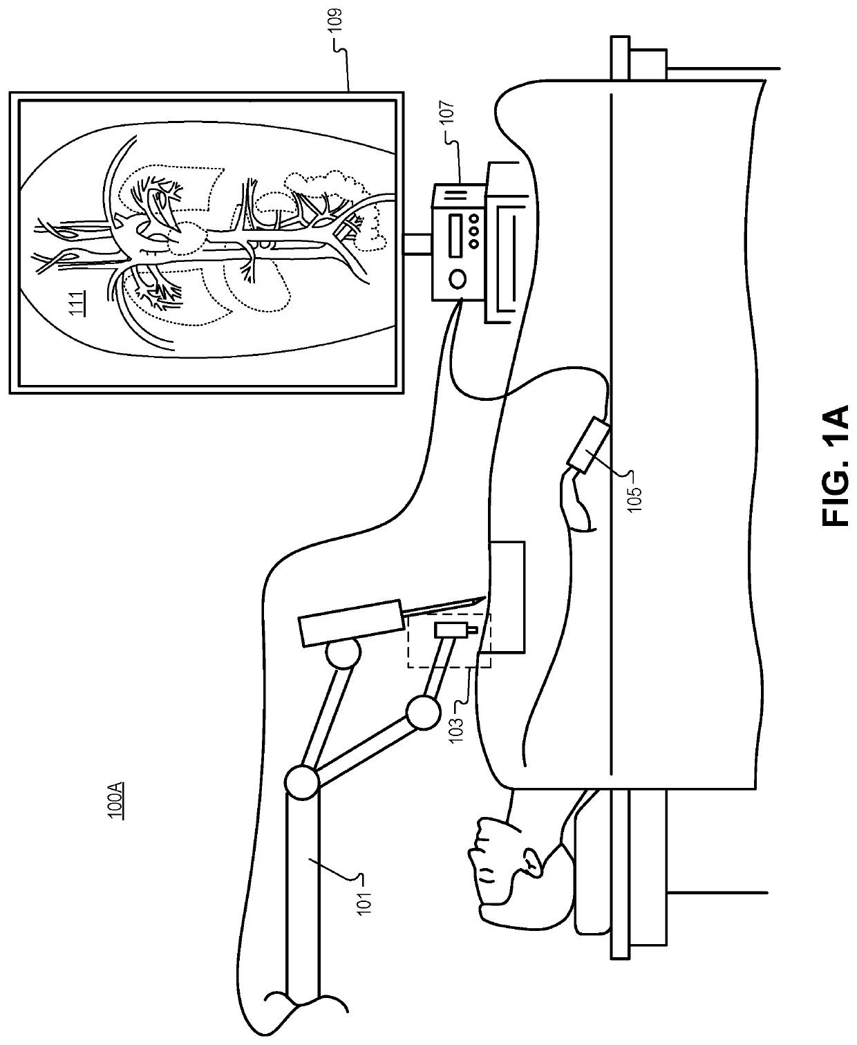 Detection of blood vessels