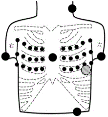 Electrocardio ultrasonic signal fusion computed tomography imaging system and method