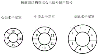 Electrocardio ultrasonic signal fusion computed tomography imaging system and method