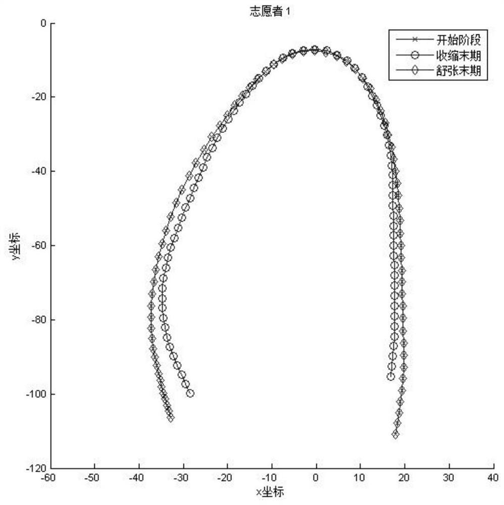 Myocardial Shape, Motion, and Deformation Analysis Methods in Two-dimensional Echocardiography Sequences